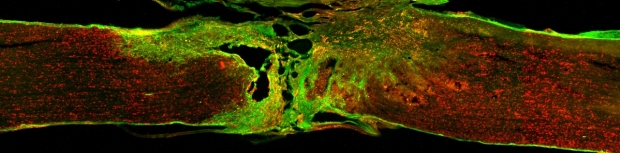 Spinal cord section showing ED1 positive macrophages (red) and laminin deposition (green) following human mesenchymal precursor cell (hMPCs) transplantation.